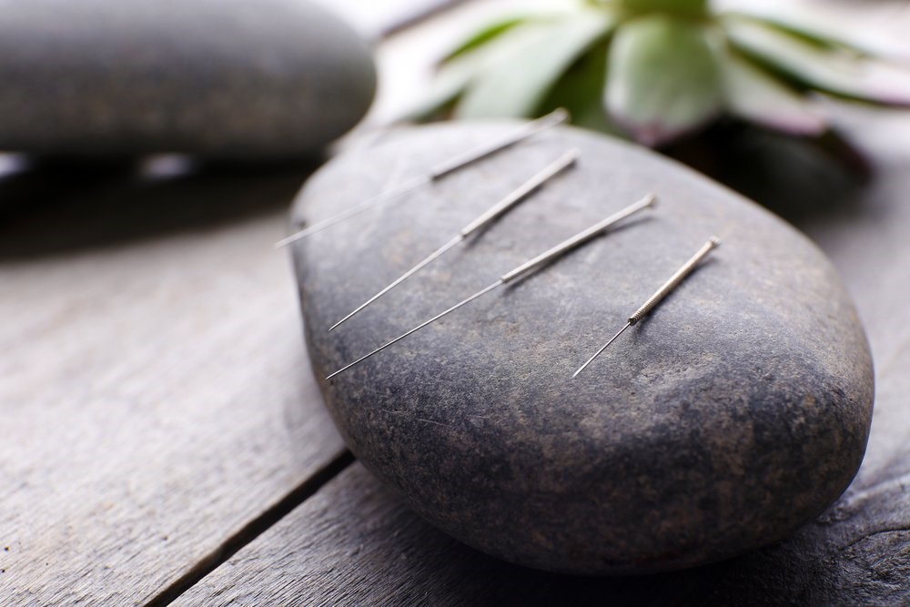 acupuncture and rocks