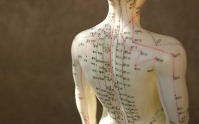 6 Things You Should Know About Acupuncture
