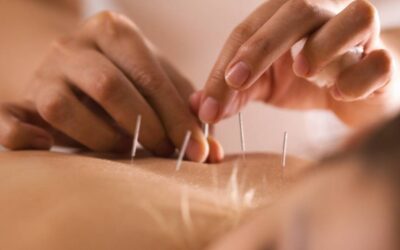 Targeting Pain Points: How Acupuncture Offers Relief for Common Ailments