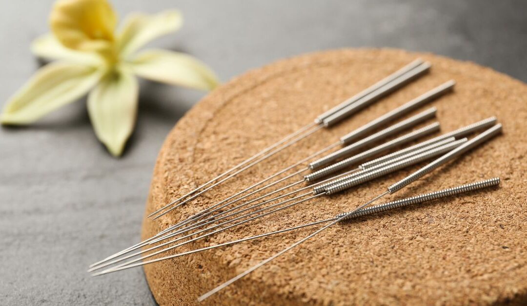 Key Health Benefits of Acupuncture